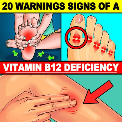 20 Warnings Signs Of A Vitamin B12 Deficiency
